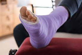 How Does A Foot Specialist Treat a Fracture?