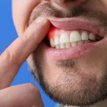 How Gum Disease Affects Your Overall Health