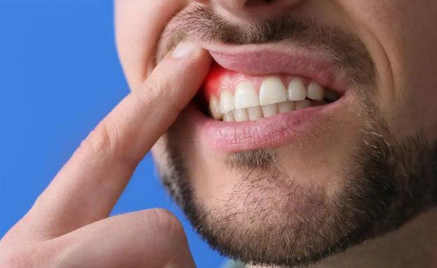 How Gum Disease Affects Your Overall Health