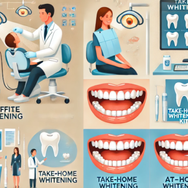 Types of Professional Teeth Whitening Services