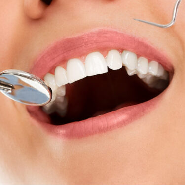 Enhancing Your Smile: The Benefits of Seeing a Cosmetic Dentist