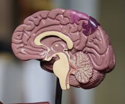 How Neurological Disorders Can Impact Movement and Coordination