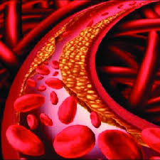 The Benefits of Nuclear Stress Tests for Diagnosing Heart Disease