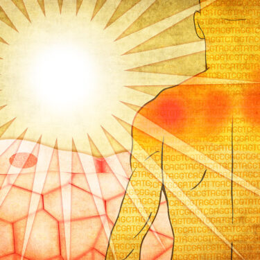 The Link Between Skin Cancer and UV Exposure