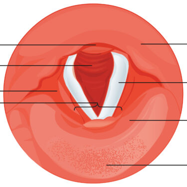 Understanding the Different Types of Voice Disorders and Their Treatment Options