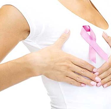 Understanding the Stages of Breast Cancer