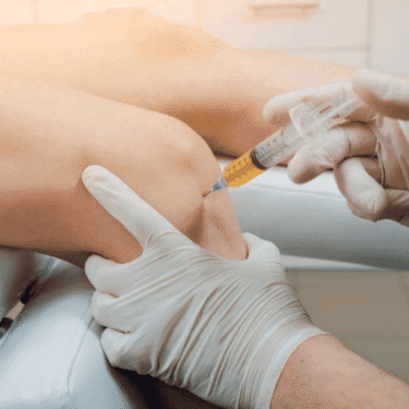 What to Expect During a PRP Treatment Session