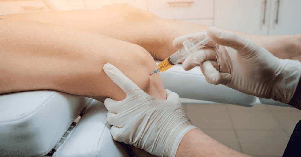 What to Expect During a PRP Treatment Session