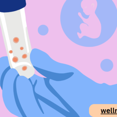 Why Egg Freezing Is Becoming an Increasingly Popular Option for Women