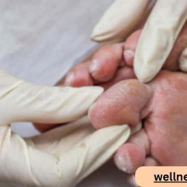 How Podiatrists Help Manage Diabetes-Related Foot Conditions