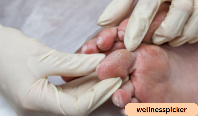How Podiatrists Help Manage Diabetes-Related Foot Conditions