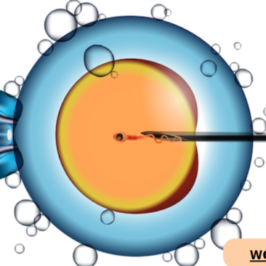 The Costs and Benefits of In-Vitro Fertilization