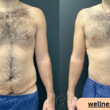 The Role of a Plastic Surgeon in Body Contouring