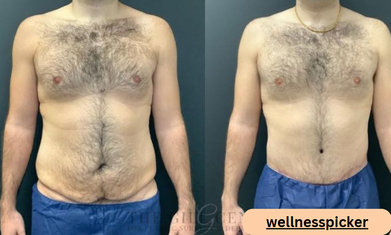 The Role of a Plastic Surgeon in Body Contouring