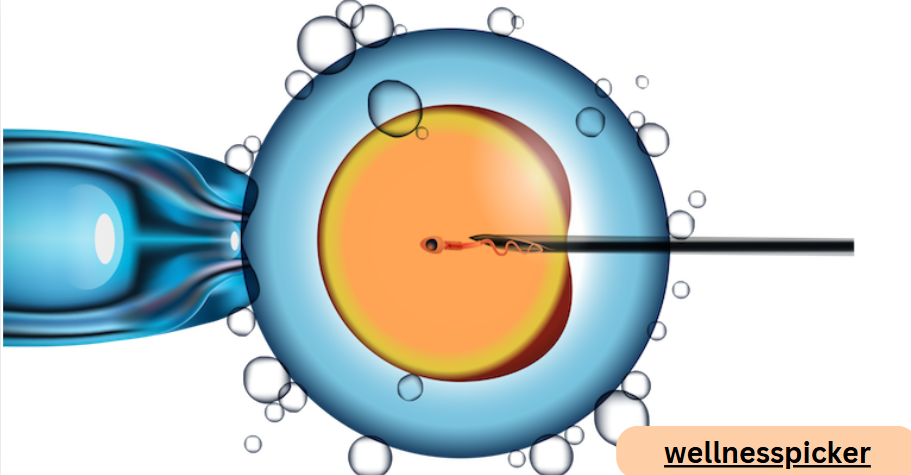 The Costs and Benefits of In-Vitro Fertilization
