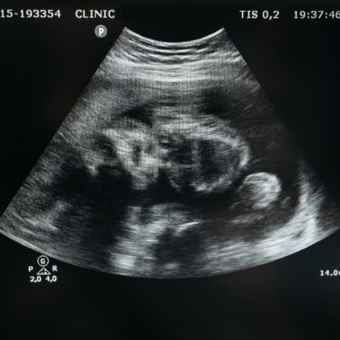 The Role of Obstetrics in Maternal and Fetal Health