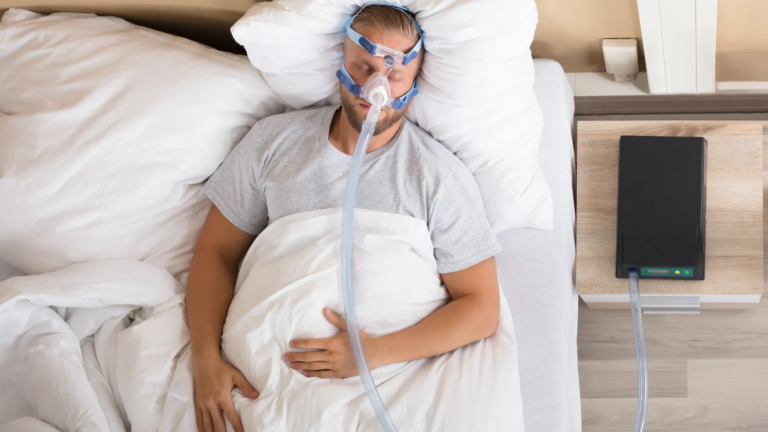 How to Treat Acid Reflux Without Medication: A Simple, Natural Guide